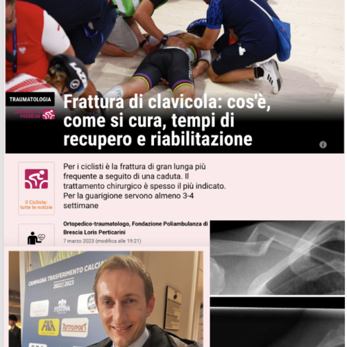 Intervista Gazzetta dello Sport 2023 Fratture Clavicola